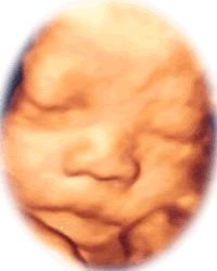 赤ちゃんの写真