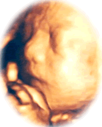 赤ちゃんの写真