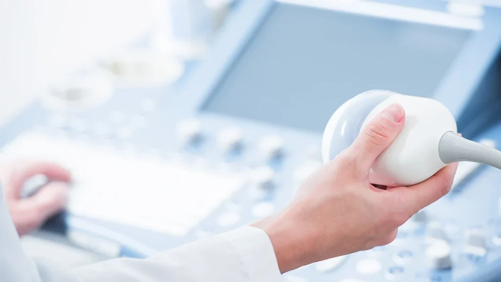 エコー検査の写真