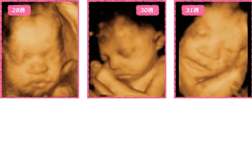 8ヶ月(28週~31週)の赤ちゃんの写真